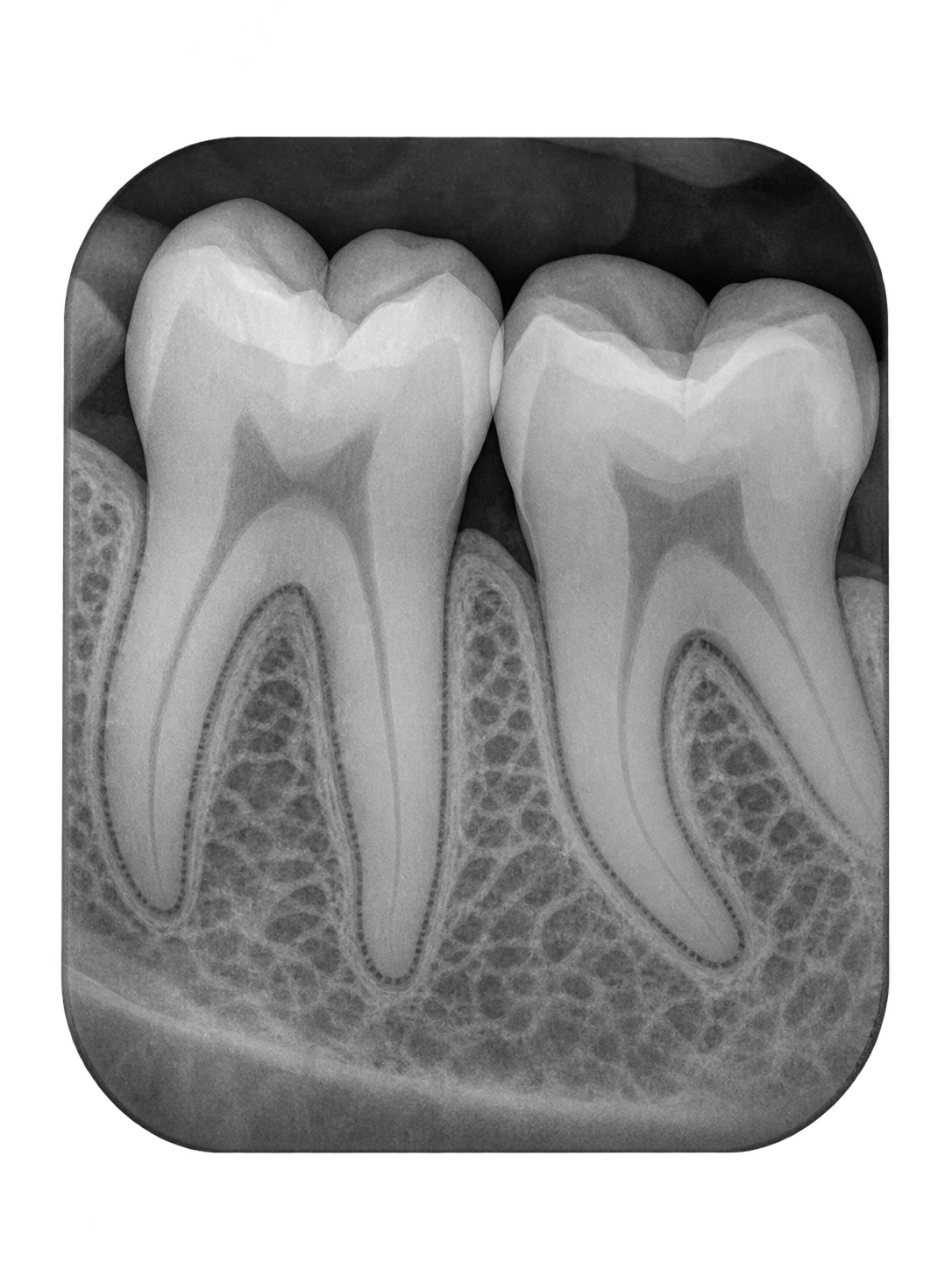 Radiografía periapical dental de la historia clínica