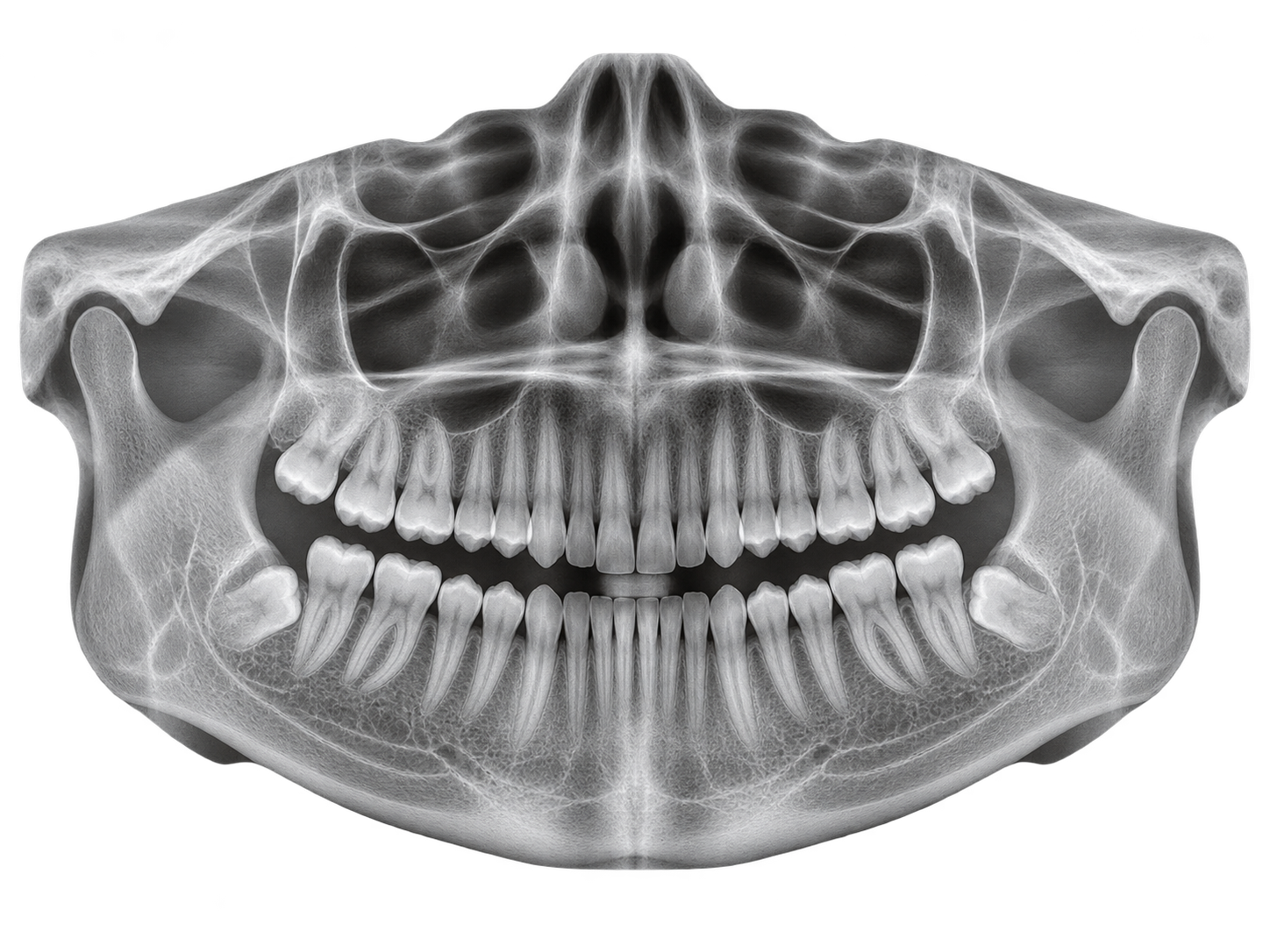 Radiografía panorámica dental de la historia clínica